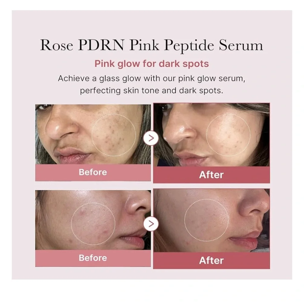 Medicube Pore Pink Peptide Serum